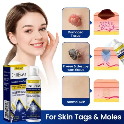 ChillErase Gentle Bump Renewal Spray - Image 2