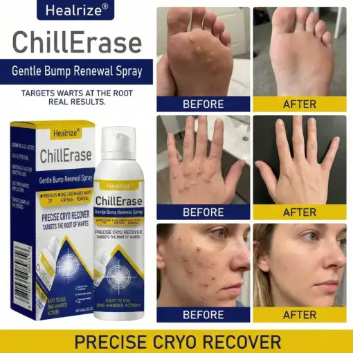 ChillErase Gentle Bump Renewal Spray - Image 3