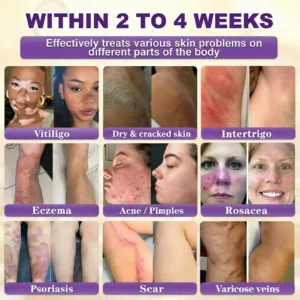 Alternative view of 🔥LAST DAY 50% OFF Biotin 10-in-1 Skin Restoration Cream