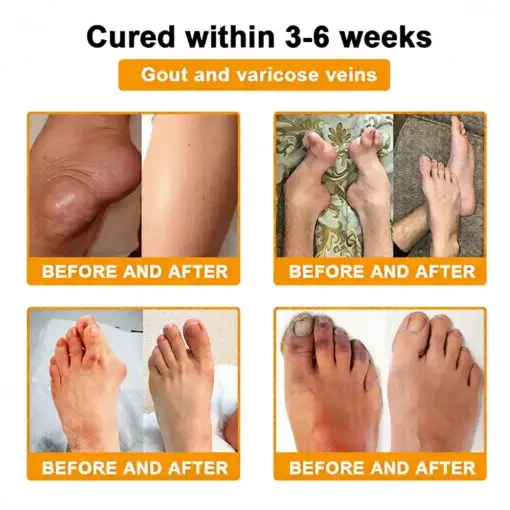 Bee Poison Pain-Relief Bone Healing Cream - Image 3