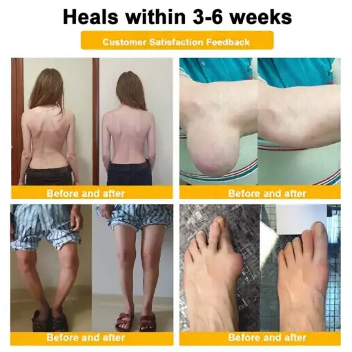 Bee Poison Pain-Relief Bone Healing Cream - Image 6