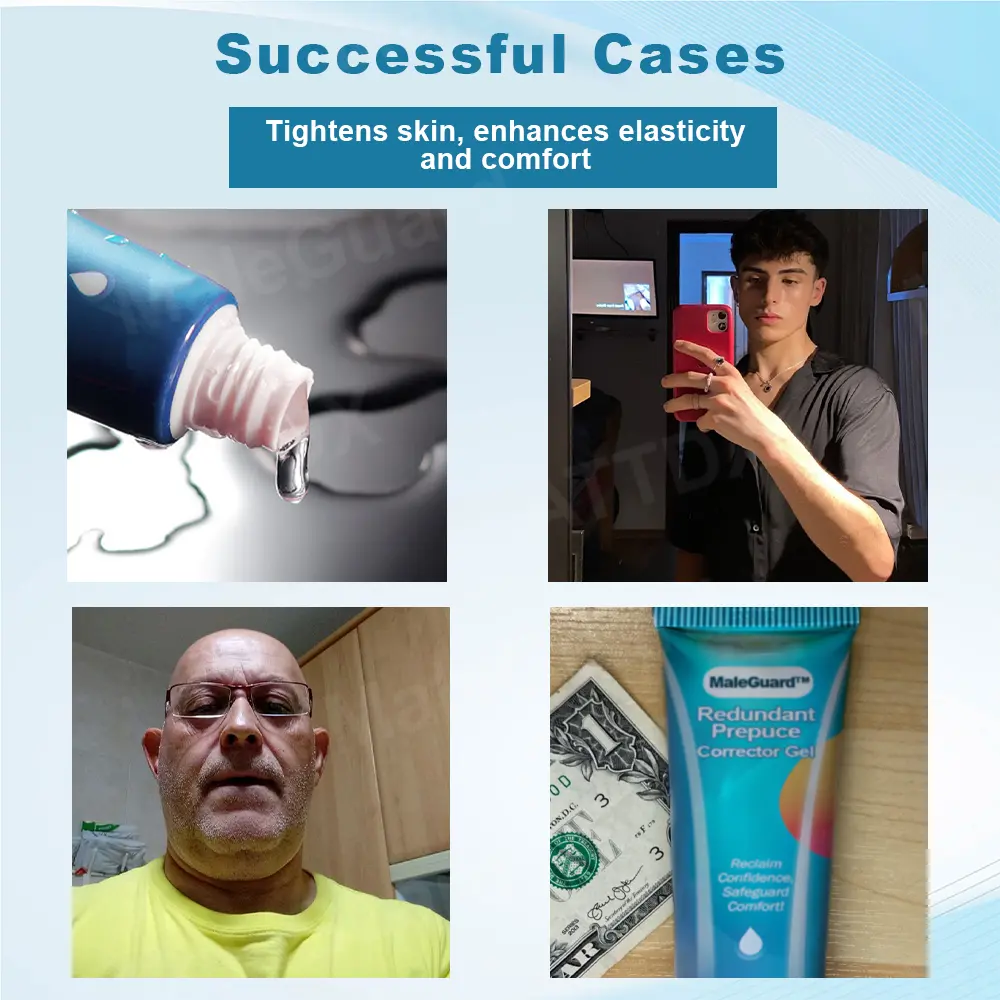 Redundant PrepuceCorrector Gel - Image 3