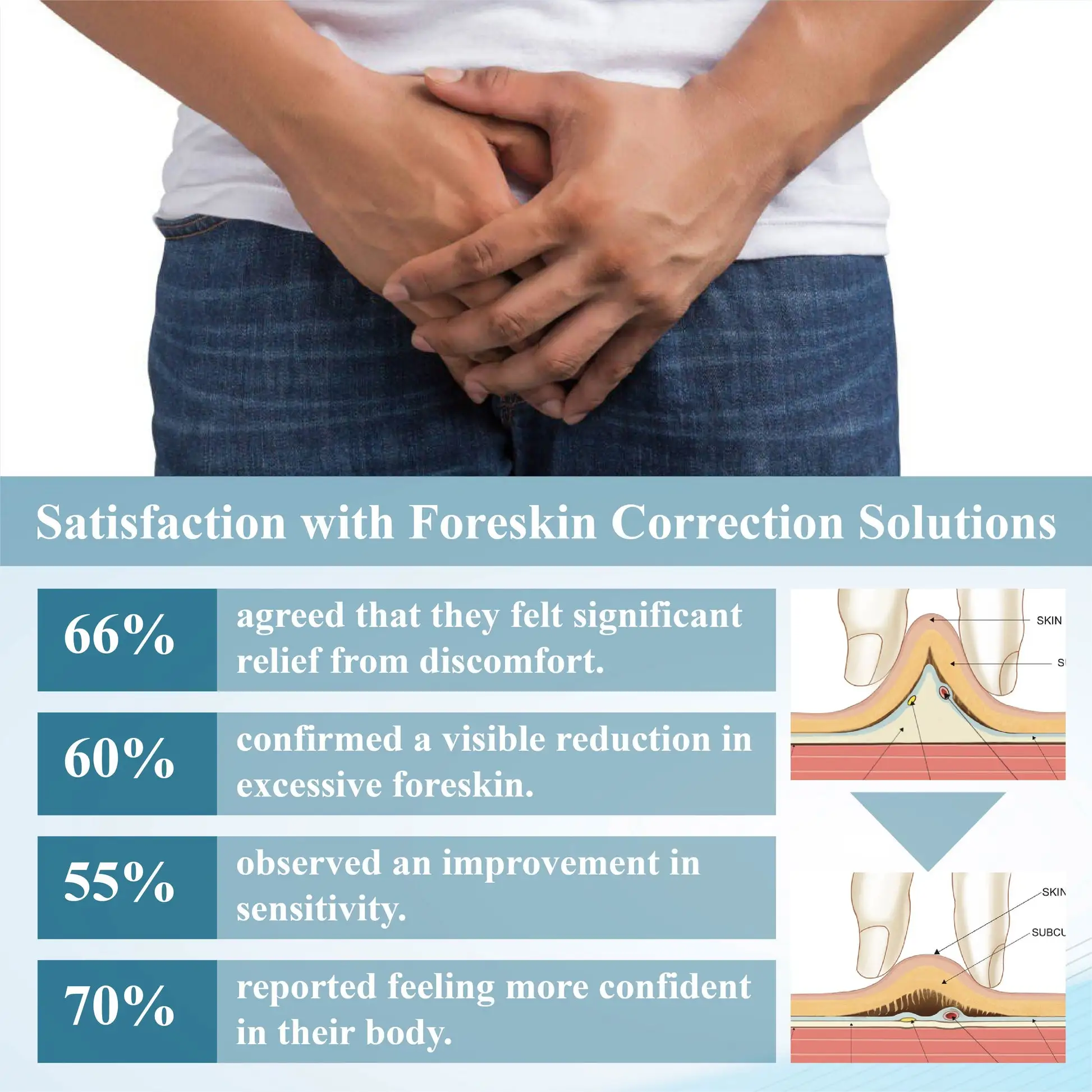 Redundant PrepuceCorrector Gel - Image 7