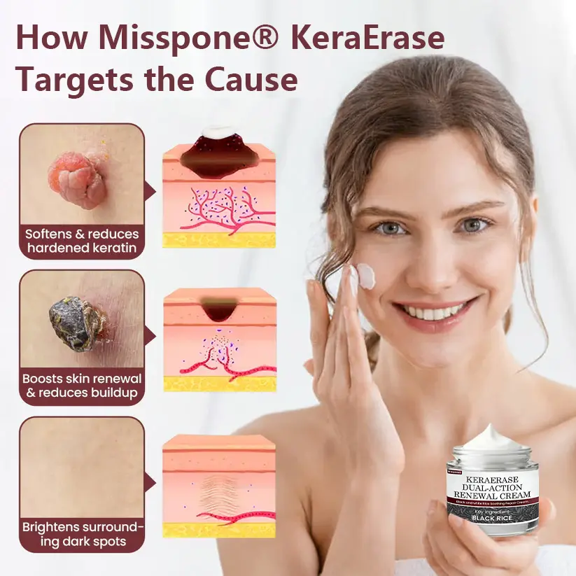 KeraErase Dual-Action Renewal Cream - Image 2