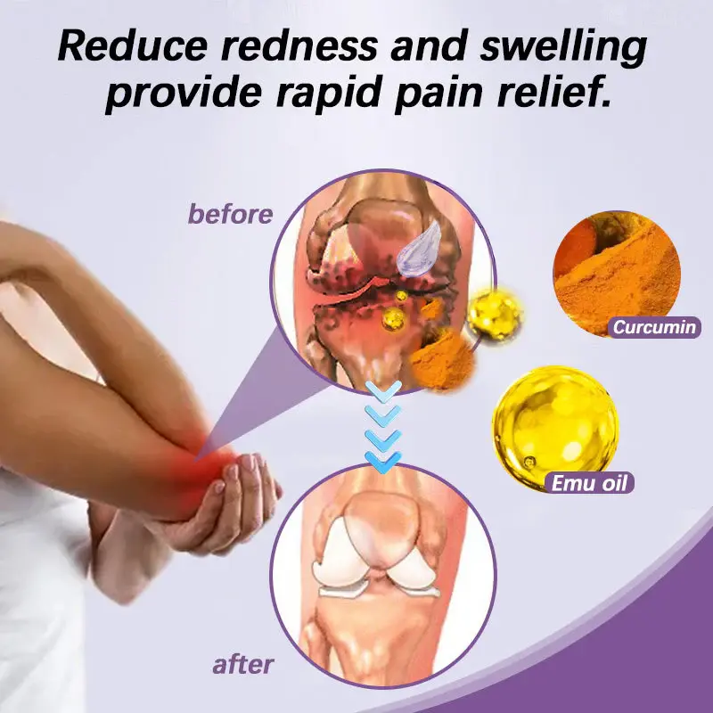 SynoJoint Synergy Gel with Turmeric & Emu Oil - Image 6