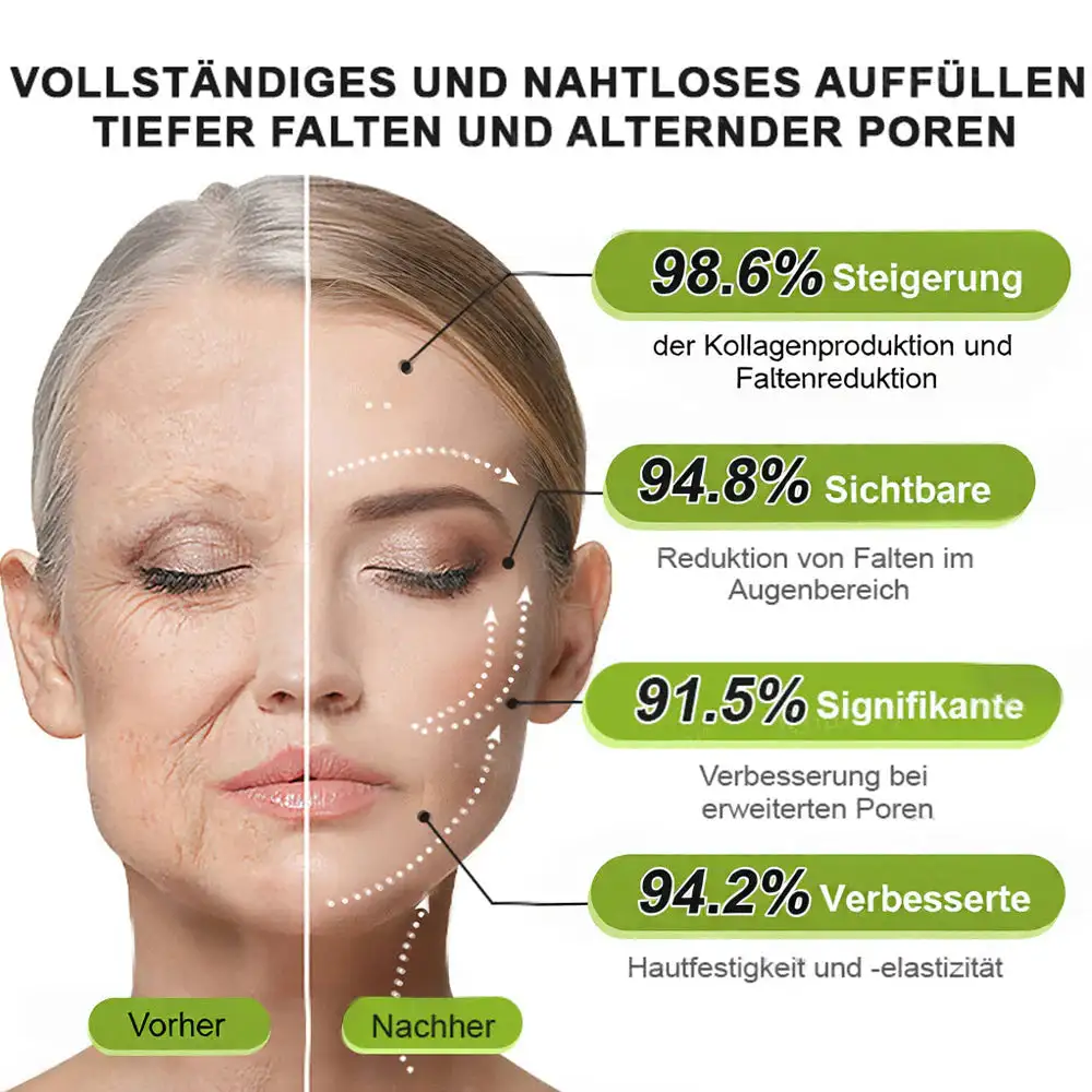 Now regain youthful skin. 💫👨⚕️ NESLEMY ™ Wrinkle relaxer & Vita-A Retinol Shot Wrinkle Lift Firming Cream - Image 16