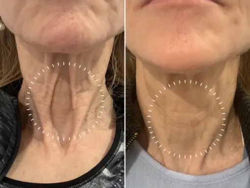 Bee venom Pro Comprehensive Cream - Image 2