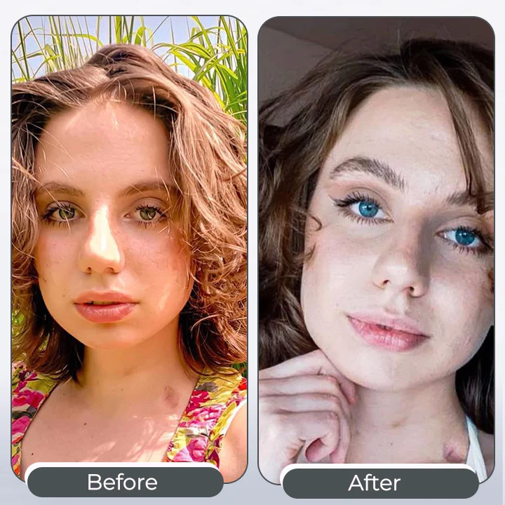 IrisInk Eye Drops - Image 3