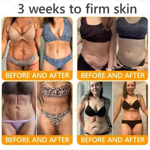 Bee Venom Wrinkle-Firming Multi-purpose Cream - Image 3