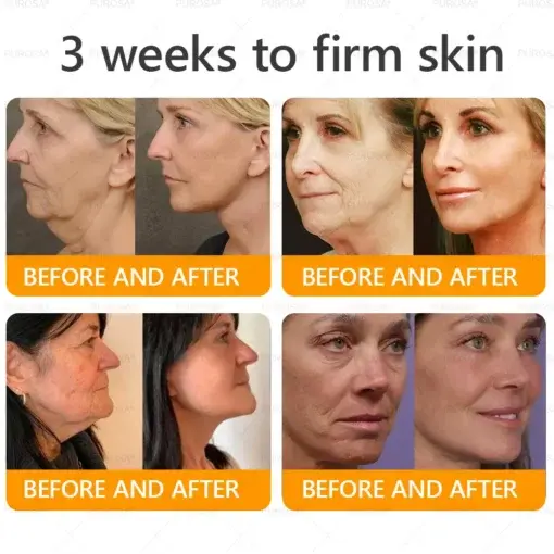 Bee Venom Wrinkle-Firming Multi-purpose Cream - Image 4