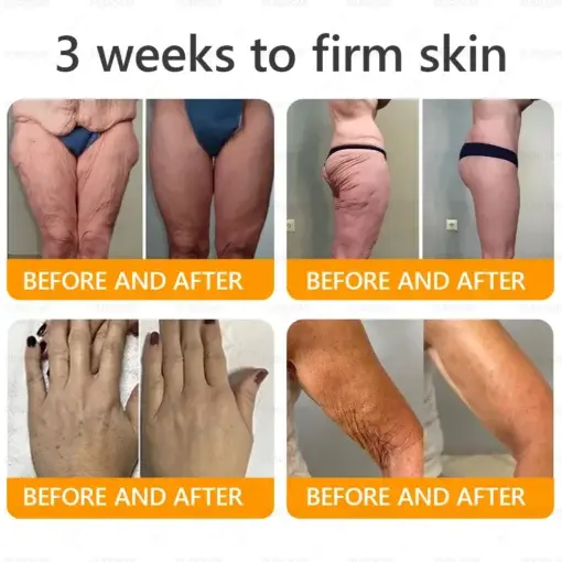 Bee Venom Wrinkle-Firming Multi-purpose Cream - Image 5