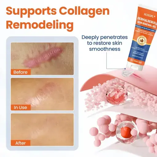 DermalRebuild Skin Renewal Gel - Image 3