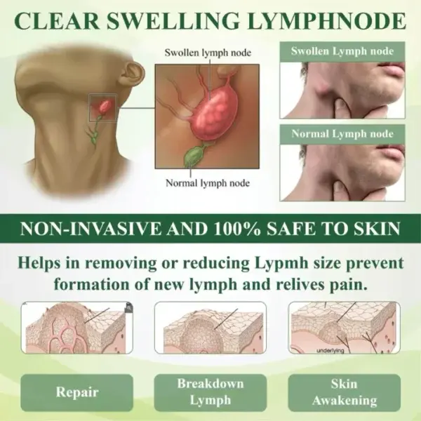 Leg Therapy Edema Cream - Image 9