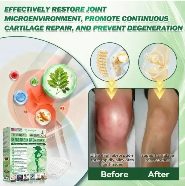 ๐ด๐๐๐๐๐๐ฎ ยท ๐๐ฒ๐ฟ๐ฏ๐ฒ๐ฟ๐๐ฃ๐ ร ๐๐ผ๐+ ๐๐-๐ข๐ง-๐ ๐๐ฑ๐๐ฎ๐ป๐ฐ๐๐ ๐๐๐ฃ๐ค ๐๐๐๐ง๐ค๐ฃ๐๐๐๐ฅ๐ ๐๐๐ญ๐๐ - Image 5