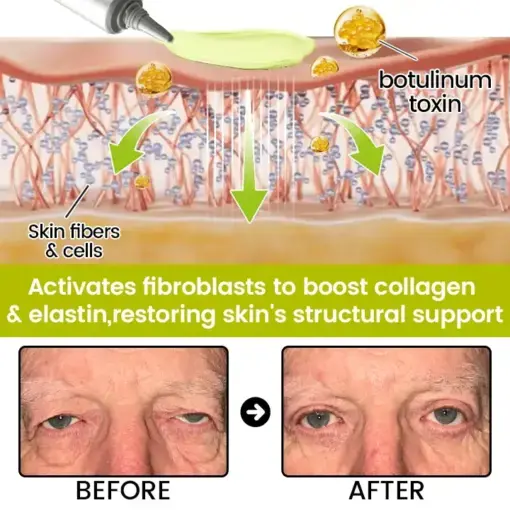 Botox Retinol Shot Smoother-Looking Skin for Deep Lines, Sagging Jowls Puffy Eyes - Image 11