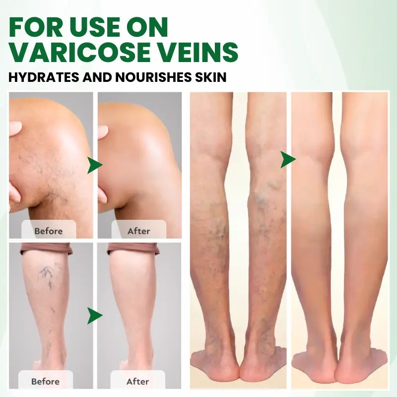 Phyto-Vascular Microneedle Patch - Image 4