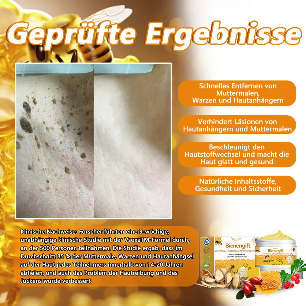 Bienengift Waren & Muttermalenfernung Creme - Image 3