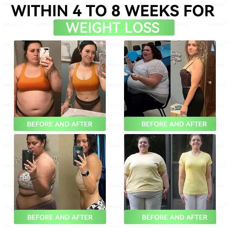 𝐌𝐨𝐫𝐢𝐧𝐠𝐚 × 𝐁𝐞𝐫𝐛𝐞𝐫𝐢𝐧𝐞 × 𝐍𝐀𝐃+ 𝟏𝟎-𝐁𝐞𝐧𝐞𝐟𝐢𝐭 𝐒𝐥𝐢𝐦𝐦𝐢𝐧𝐠 𝐏𝐚𝐭𝐜𝐡 - Image 3