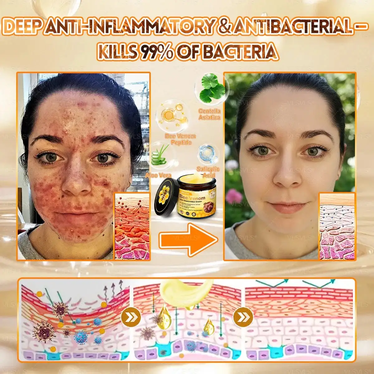 Alcuras Bee Venom Cream – Fast Skin Repair - Image 5