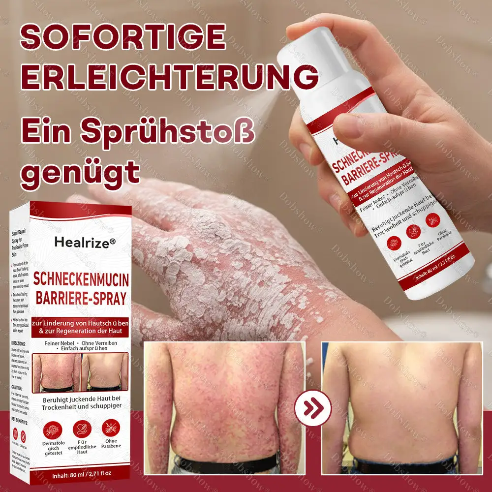 Schneckenmucin-Barriere-Spray zur Linderung von Hautschรผben und zur Regeneration der Haut-๐ฟ๐๐ช๐ฉ๐จ๐๐๐ก๐๐ฃ๐๐จ ๐๐ง. 1 ๐จ๐ฅ๐งรผ๐๐๐๐ง๐ ๐ฝ๐๐ง๐ง๐๐๐ง๐-๐๐๐ก๐๐๐ ๐๐๐ ๐๐จ๐ค๐ง๐๐๐จ๐๐จ - Image 2