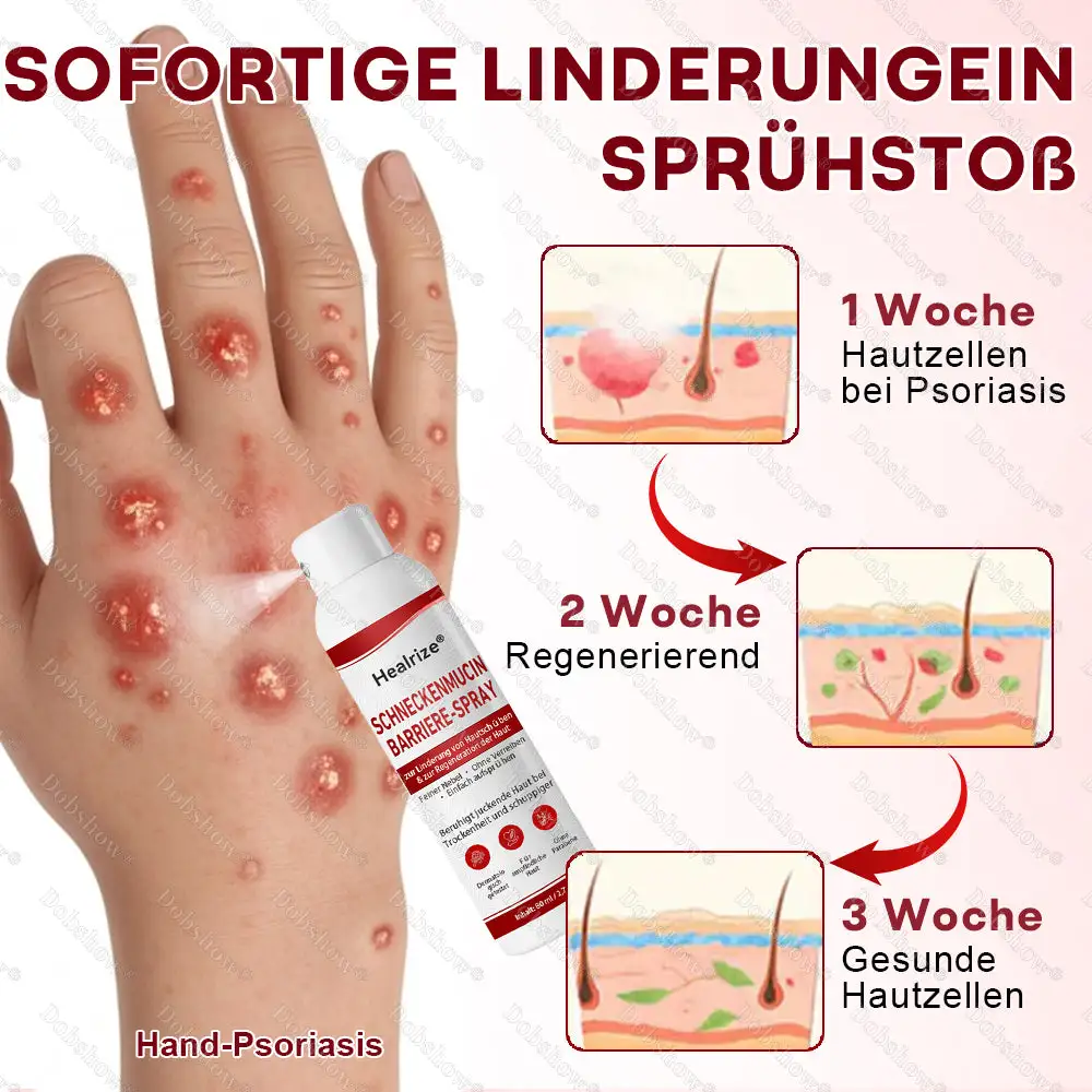 Schneckenmucin-Barriere-Spray zur Linderung von Hautschรผben und zur Regeneration der Haut-๐ฟ๐๐ช๐ฉ๐จ๐๐๐ก๐๐ฃ๐๐จ ๐๐ง. 1 ๐จ๐ฅ๐งรผ๐๐๐๐ง๐ ๐ฝ๐๐ง๐ง๐๐๐ง๐-๐๐๐ก๐๐๐ ๐๐๐ ๐๐จ๐ค๐ง๐๐๐จ๐๐จ - Image 5