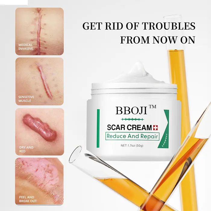 Scar Removal Cream - Image 4