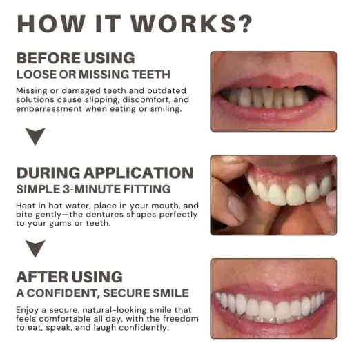 Custom-Fit Full Denture Set - Image 4