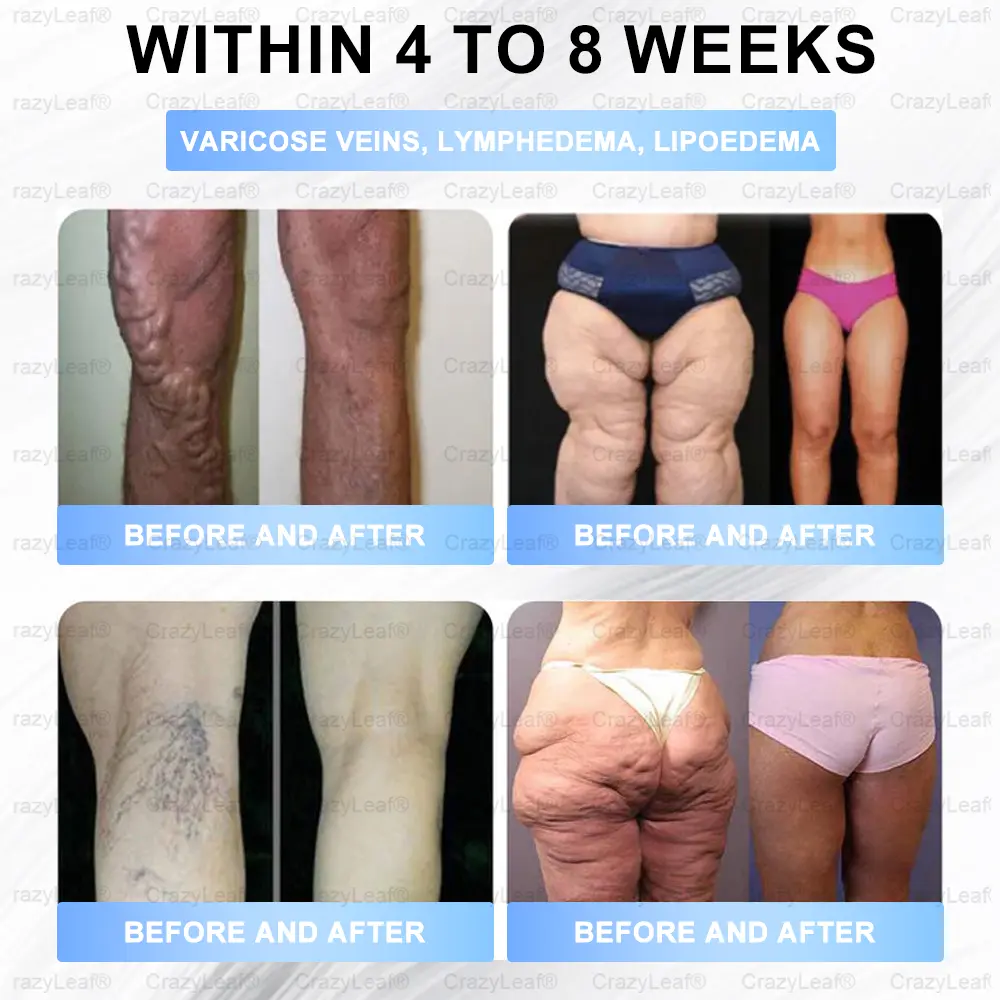 Slimming Patch with Collagen - Image 7
