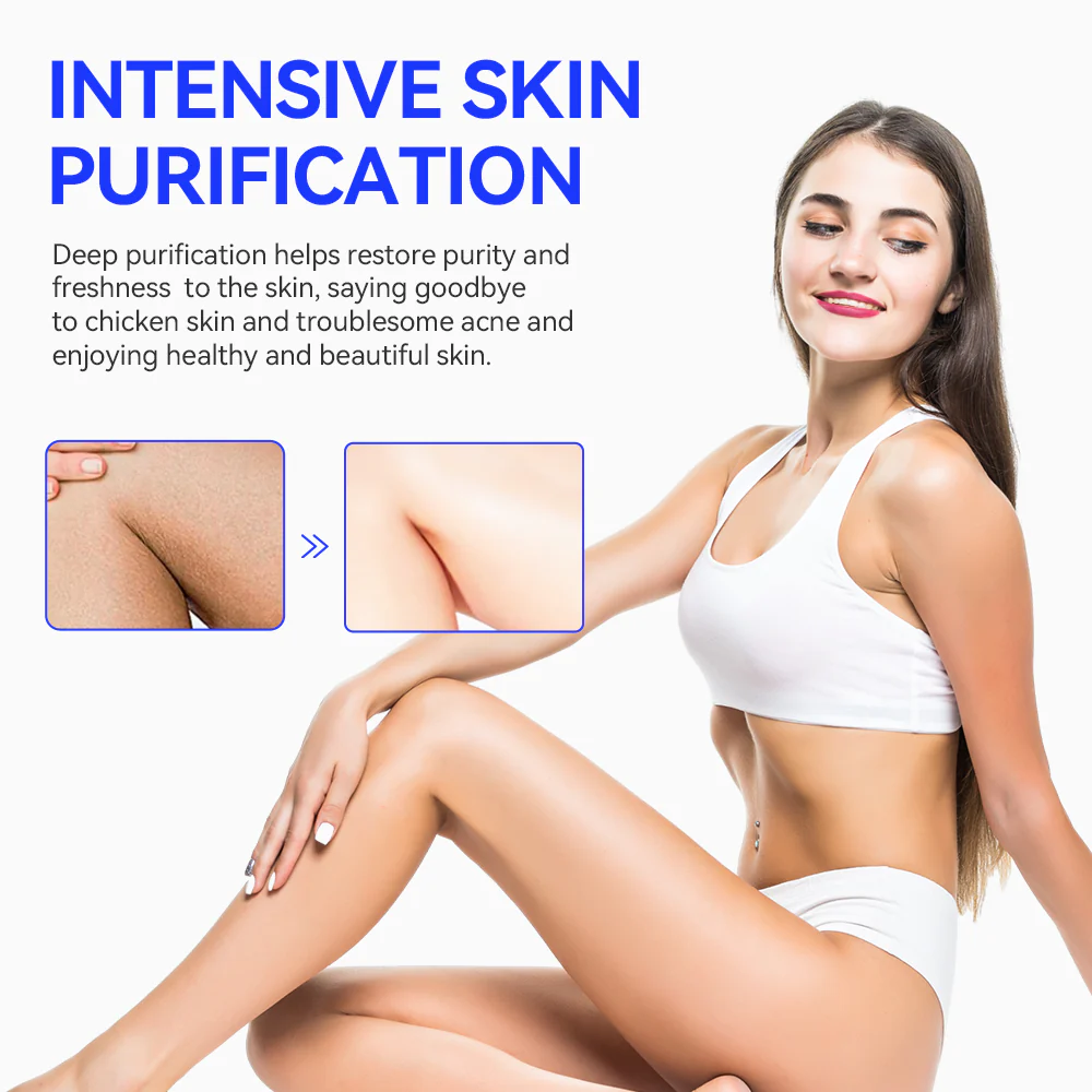 Keratosis Pilaris & Akne Behandlung Körper Erfrischende Creme - Image 2