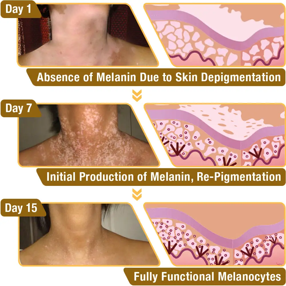 VitiGO Bee Venom Treatment Cream - Image 7