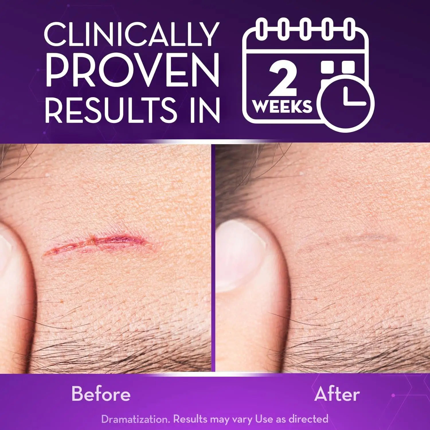 Advanced Scar Gel - Image 4
