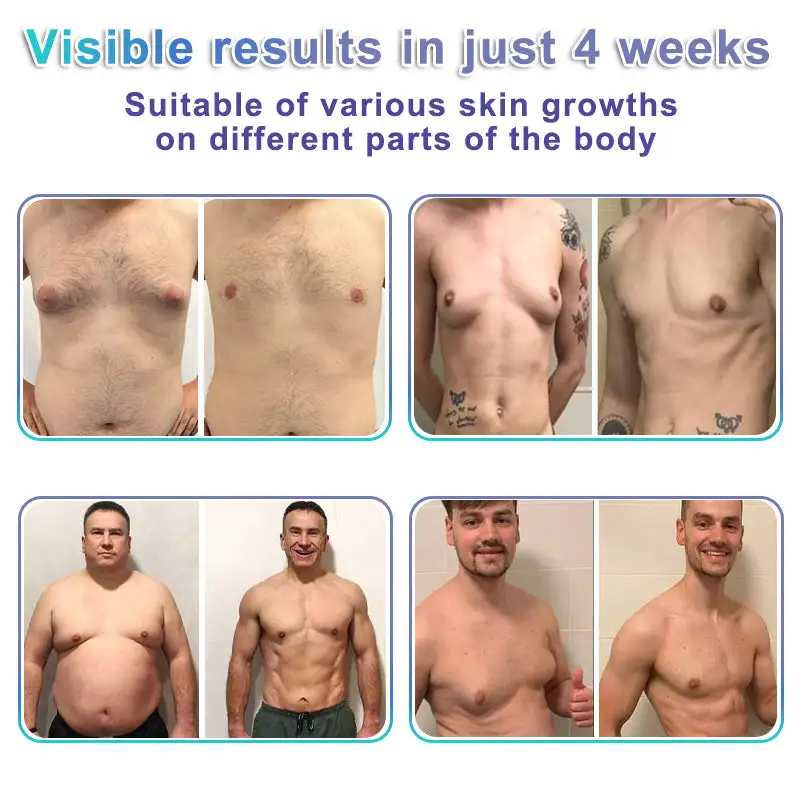 NanoMedix Gynecomastia Chest Fatburn & Firm Patch - Image 5