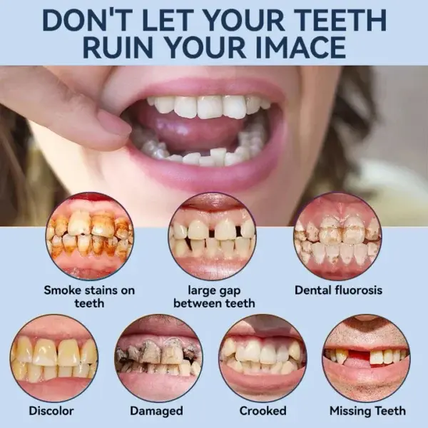 – MedicalFit Adaptive Dentures – Suitable for all mouth shapes perfect fit - Image 7