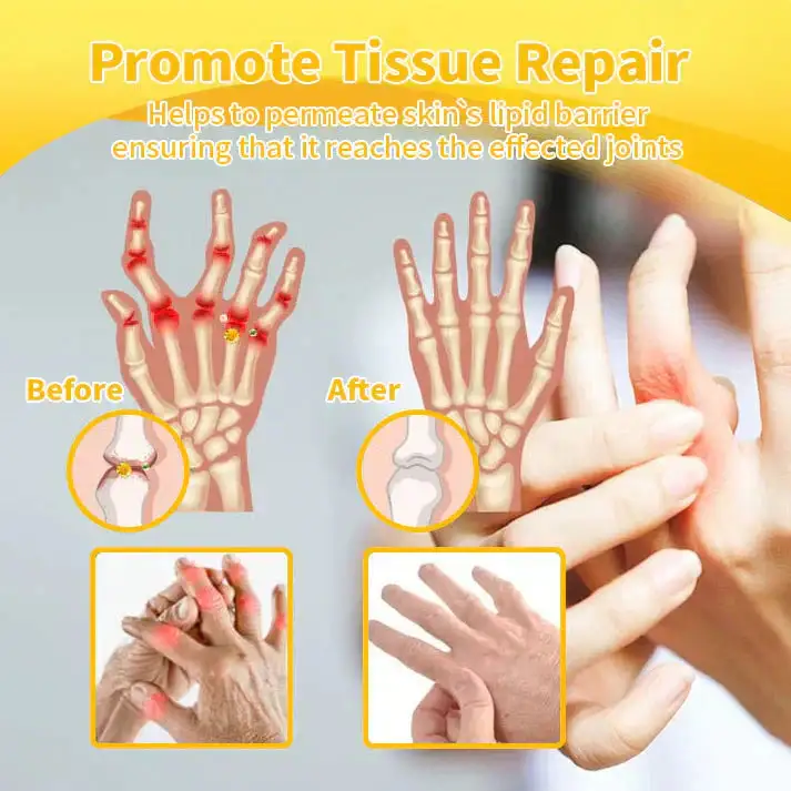 Lidocaine 5Mins Pain Relief Healing Spray - Image 12