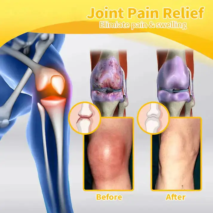 Lidocaine 5Mins Pain Relief Healing Spray - Image 13