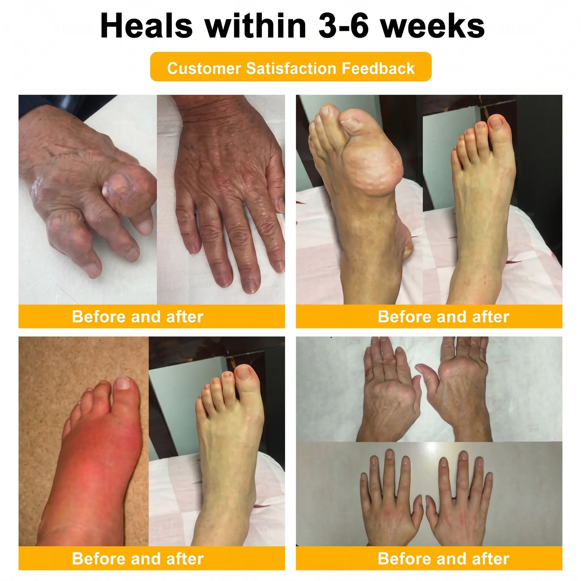 Bee Venom Pain-Relief Bone Healing Cream - Image 5