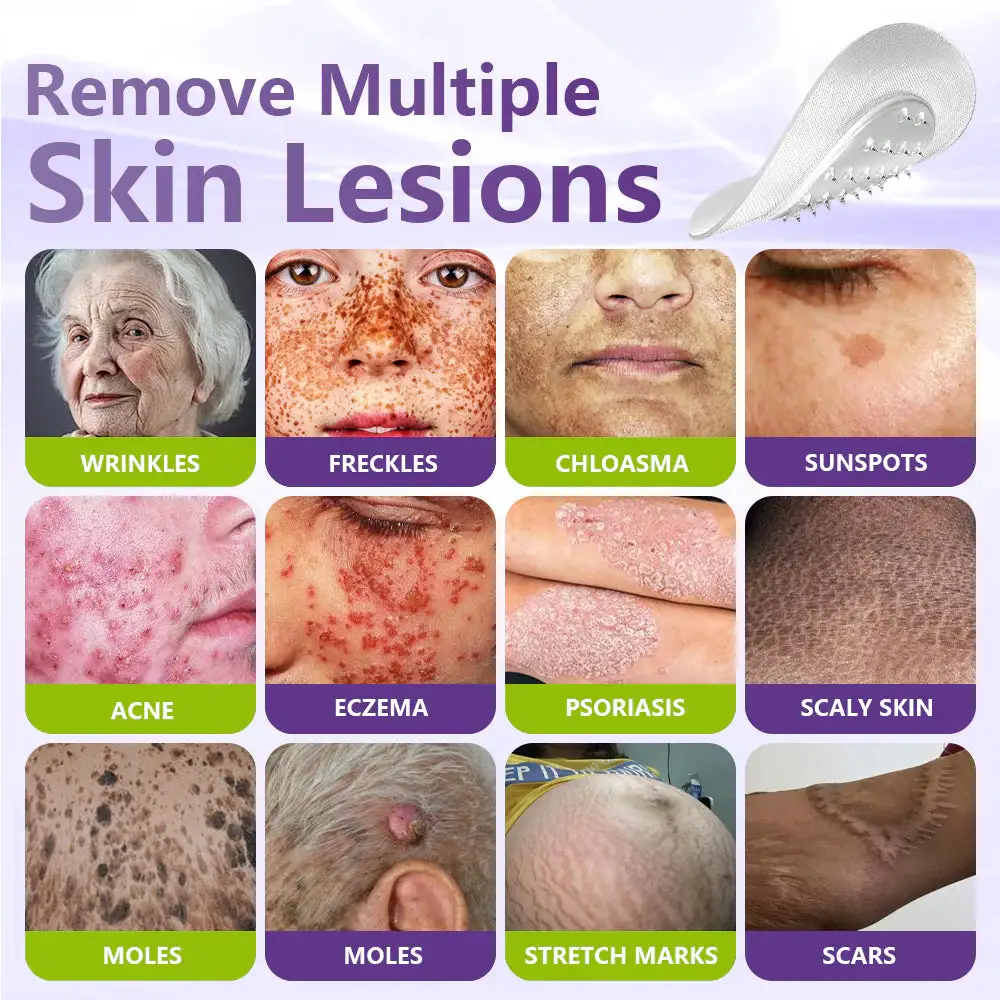 SOLUBLE MICRONEEDLE BOTANICAL SKIN TAG REMOVAL PATCH - Image 7