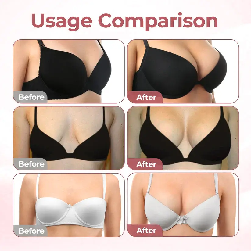 BREAST ENHANCEMENT LIFT & FIRM MICRONEEDLE PATCHES - Image 3