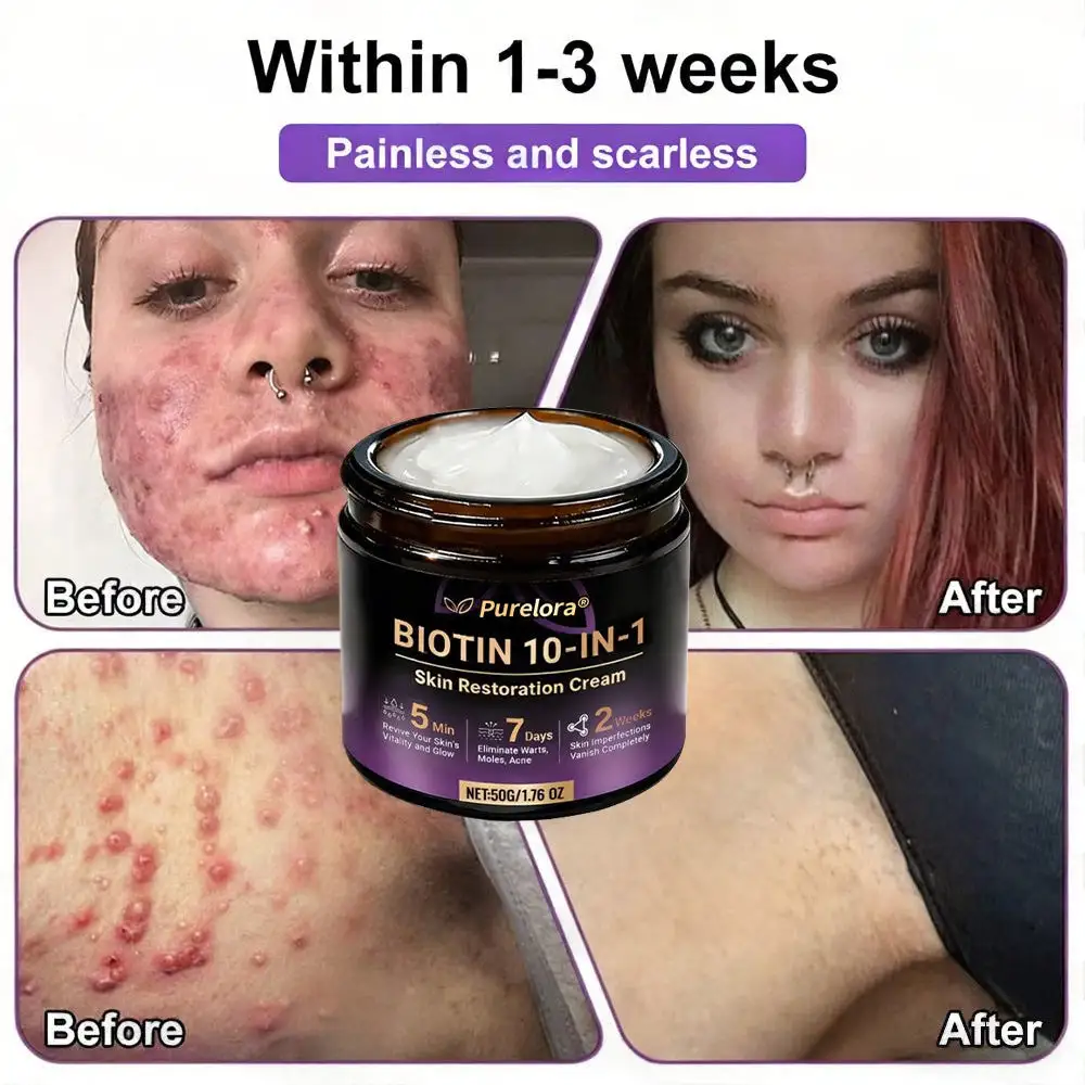 Biotin 10-in-1 Skin Repair Cream — Last Day of Sale: 75% Off - Image 6