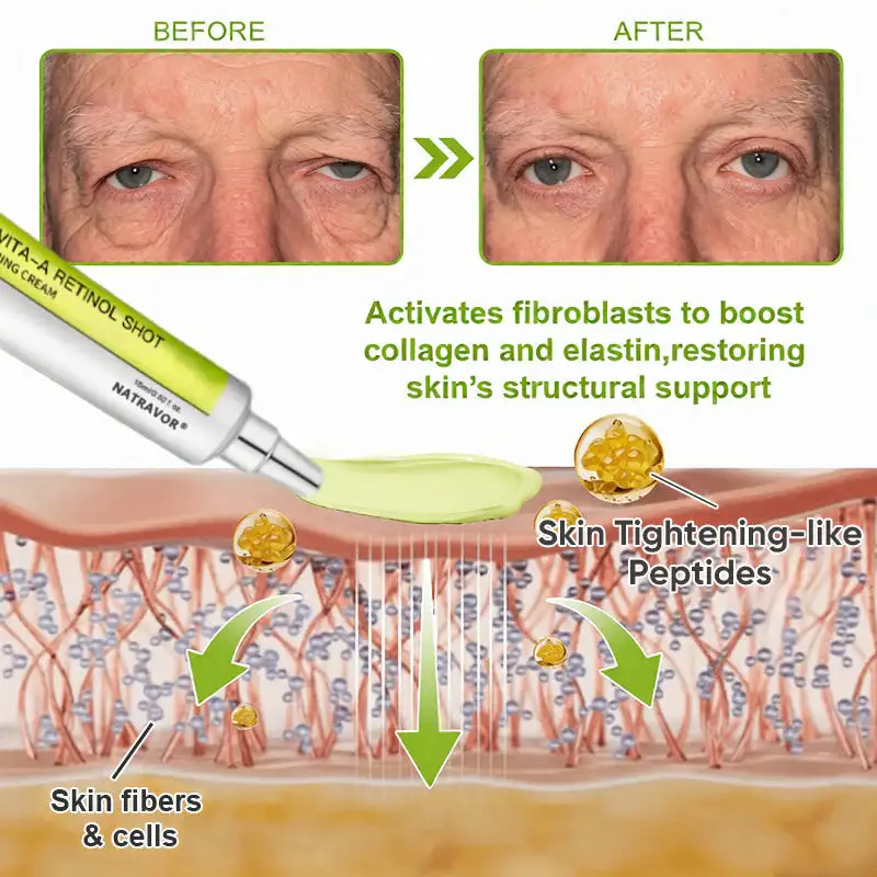 Botox & Vita-A Retinol Shot Wrinkle-Lift Tightening cream - Image 15