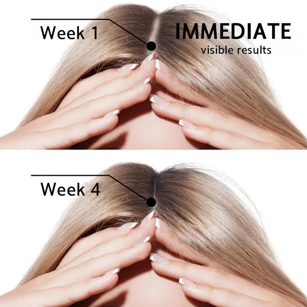 Onion & Rosemary 2-in-1 Shampoo & Conditioner with 15X Active Complex for Hair Growth - Image 11