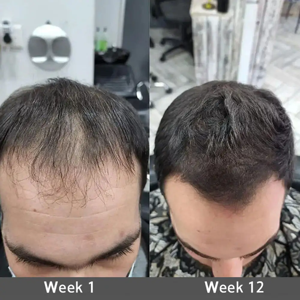 Onion & Rosemary 2-in-1 Shampoo & Conditioner with 15X Active Complex for Hair Growth - Image 8