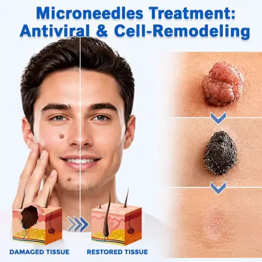2-in-1 Microneedle & Hydrocolloid Patch - Image 2