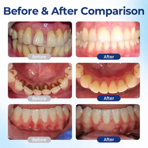 BeeTakt Oral Repair Solution - Image 3
