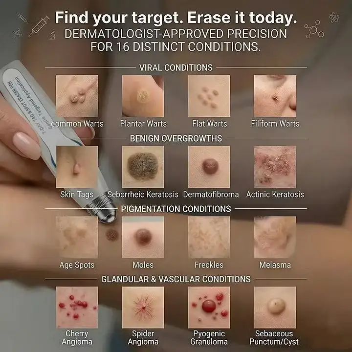 7-Day Skin Tag & Spot Eraser Painless & Scar-Free Advanced Imperfection Removal Rollerball Pen - Image 5