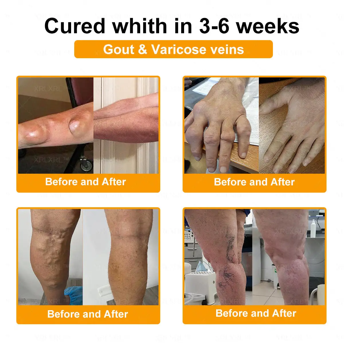 Bee Venom Pain-Relief Bone Healing Cream - Image 5