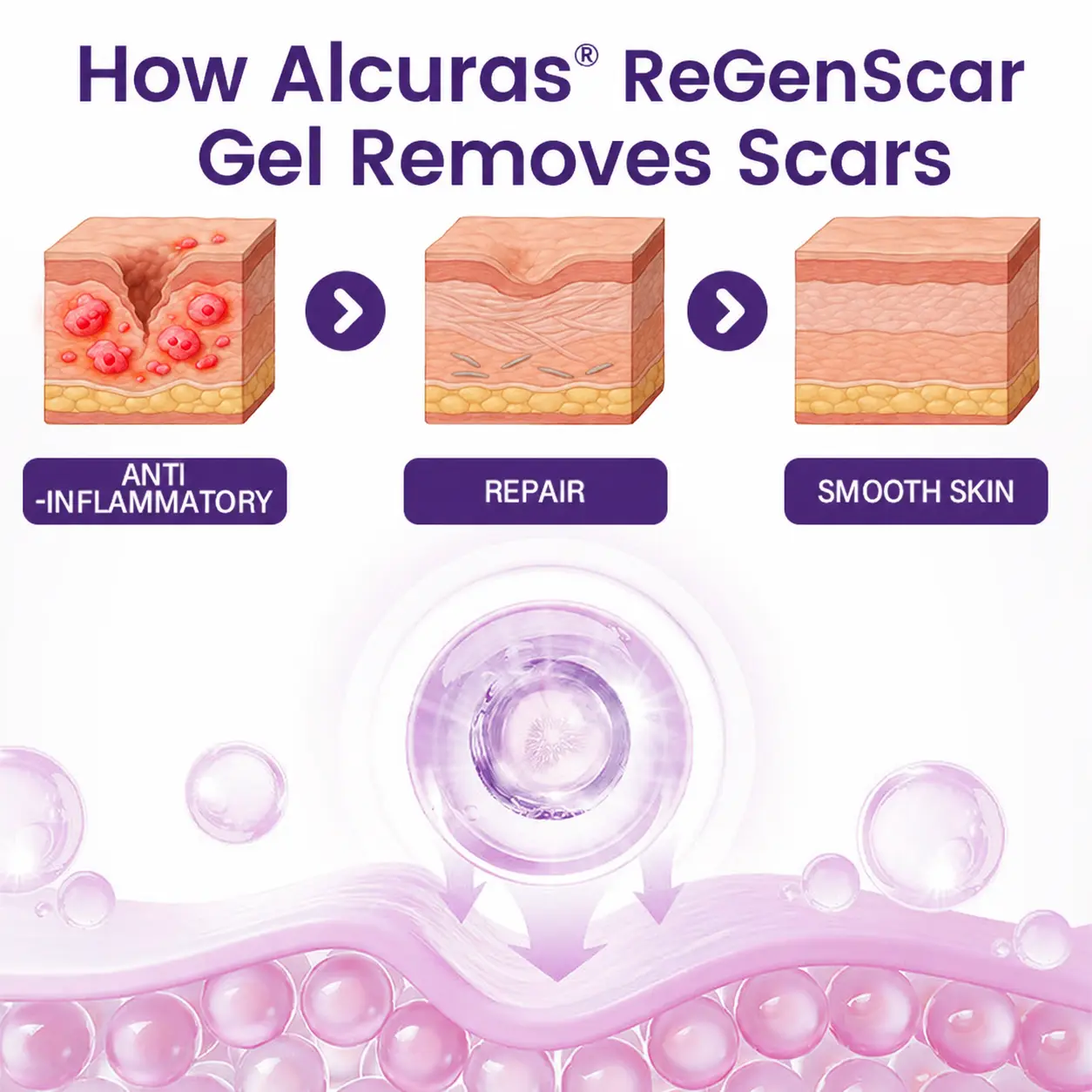 ReGenScar Stem Cell Scar Gel - Image 4