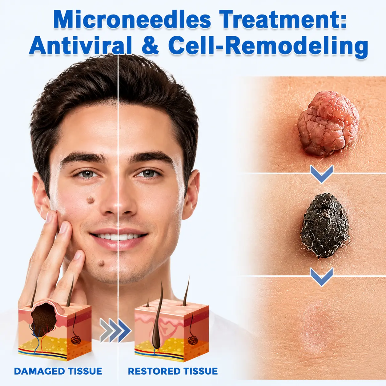 2-in-1 Microneedle & Hydrocolloid Patch - Image 6