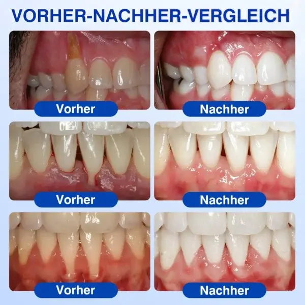 GumRevive Parodontales Reparaturgel - Image 12