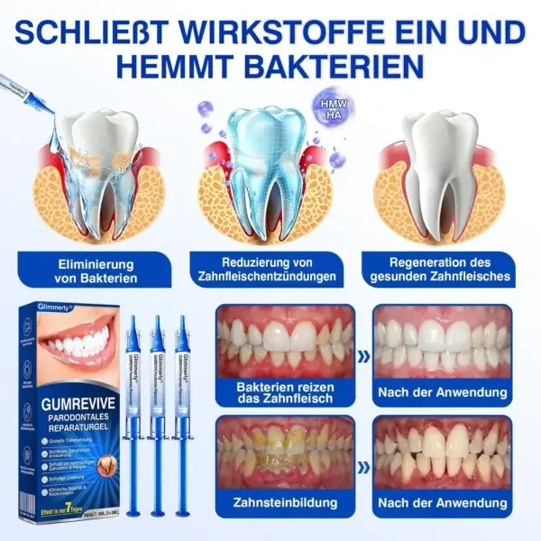 GumRevive Parodontales Reparaturgel - Image 7